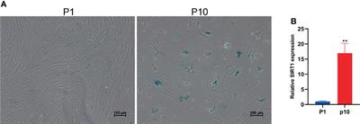 Small Noncoding RNAome Changes During Human Bone Marrow Mesenchymal Stem Cells Senescence In Vitro